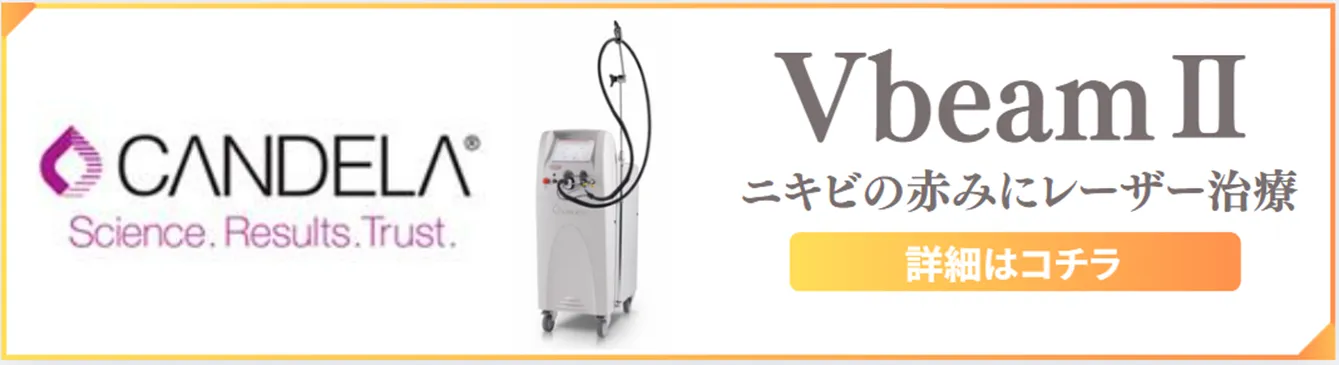 Vビームフェイシャル